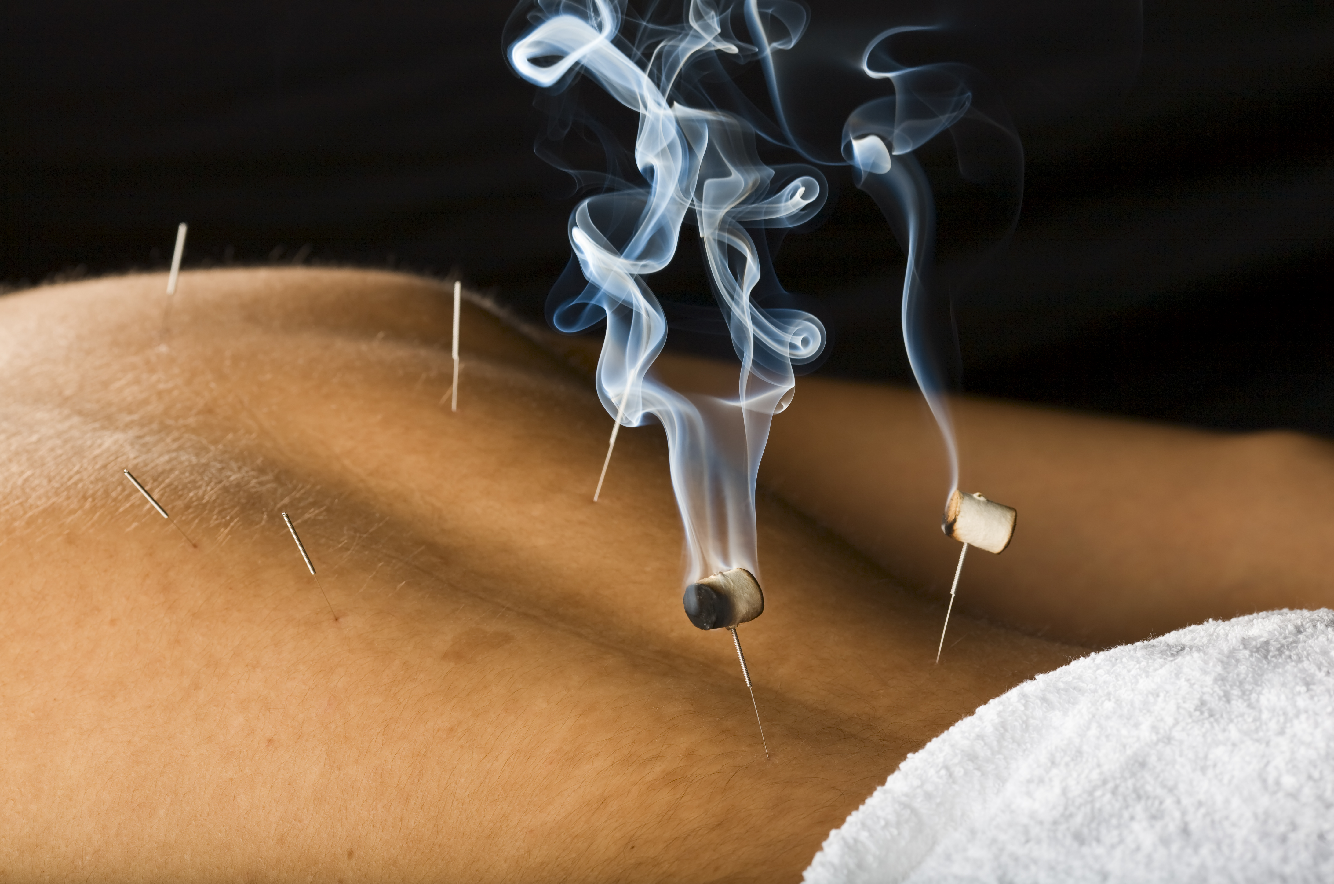 Moxibustion